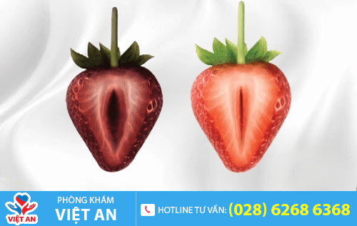 Kết quả sau khi thu hẹp âm đạo