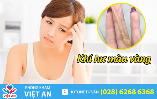Khí hư màu vàng
