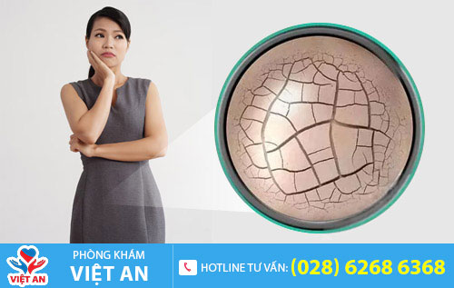 Khô âm đạo