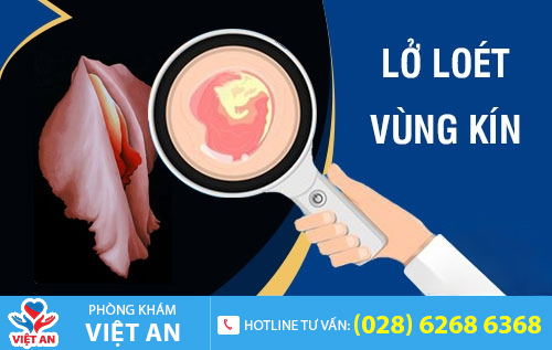 Lở loét vùng kín do bệnh lý