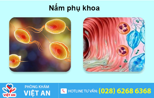 Nấm phụ khoa
