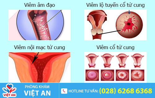 nguyên nhân đau hột le
