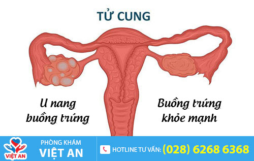 Nguyên nhân đau rát khi quan hệ