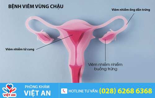 Nguyên nhân gây đau bụng dưới