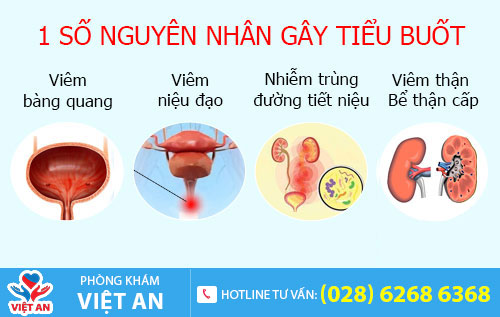 Nguyên nhân gây tiểu buốt