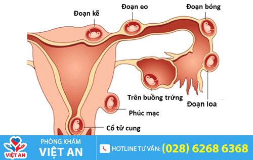 Nguyên nhân máu báo thai bất thường