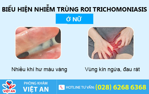 Nhiễm trichomonas ở nữ giới