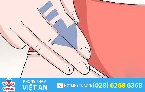 Nổi hạch vùng kín