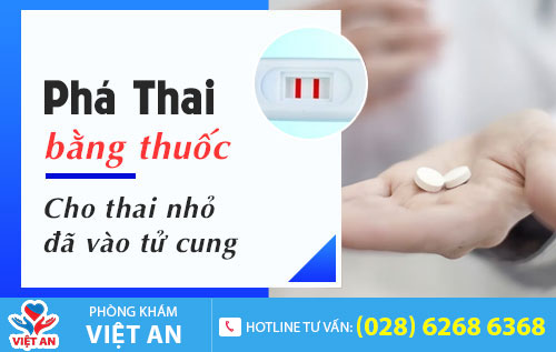 Phá thai bằng thuốc
