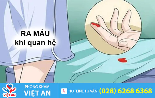 Ra máu khi quan hệ