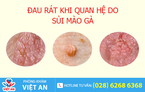 nguyên nhân đau rát khi quan hệ