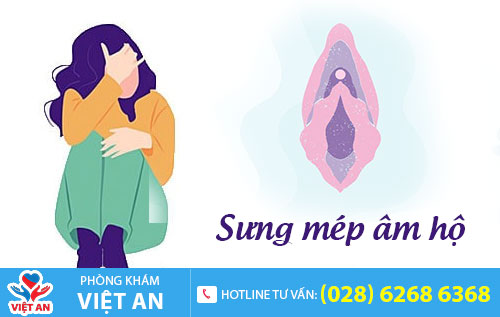 Sưng mép âm hộ