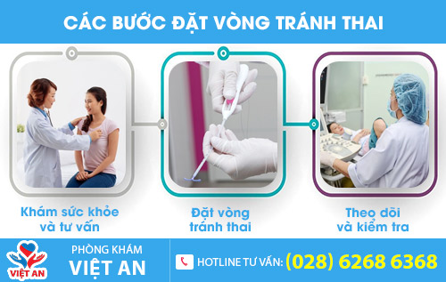 Hiểu về đặt vòng tránh thai và địa chỉ đặt vòng tránh thai uy tín
