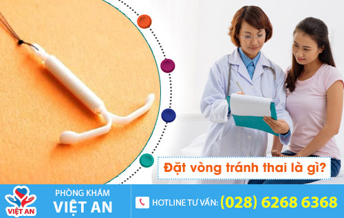 Đặt vòng tránh thai