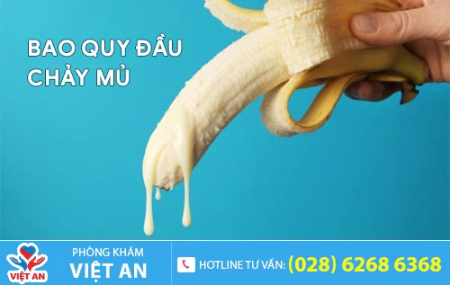 bao quy dau chay mu