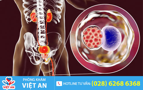 Bệnh Chlamydia
