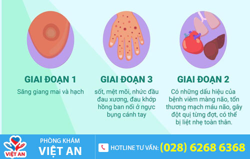 Biểu hiện bệnh giang mai