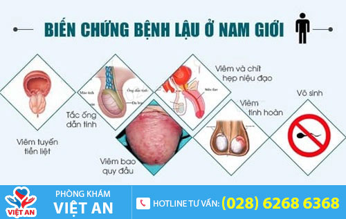 Biến chứng của bệnh lậu ở nam giới
