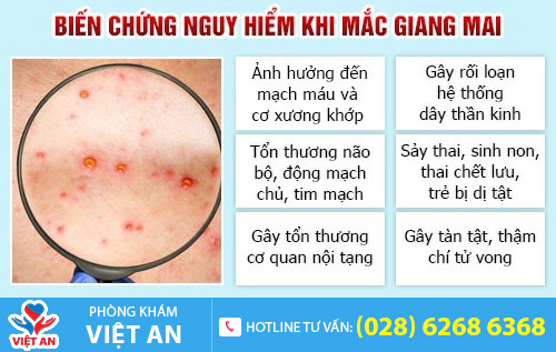 Hình ảnh giang mai giai đoạn cuối