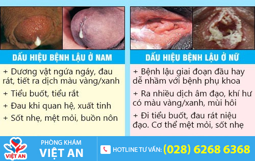 Biểu hiện của bệnh lậu
