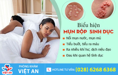 Biểu hiện mụn rộp sinh dục