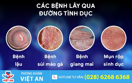 cac benh lay qua duong tinh duc