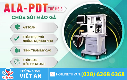 Phương pháp chữa gai sinh dục hiệu quả