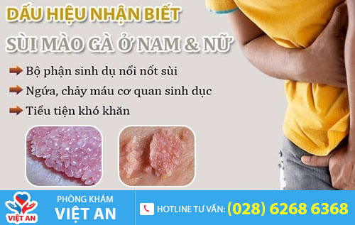 Bệnh sùi mào gà