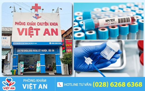 Địa chỉ xét nghiệm HPV uy tín