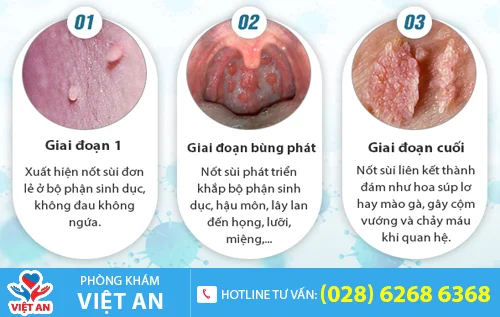 giai doan phat trien benh sui mao ga