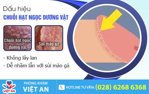Hình ảnh hạt ngọc dương vật