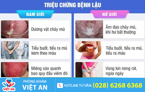 Bệnh lậu cần được điều trị càng sớm càng tốt