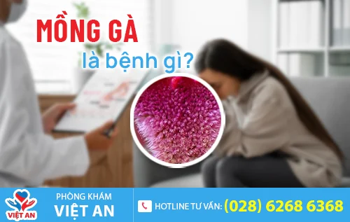 benh mong ga la benh gi
