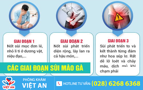 Hình ảnh bệnh nhân bị sùi mào gà ở dương vật