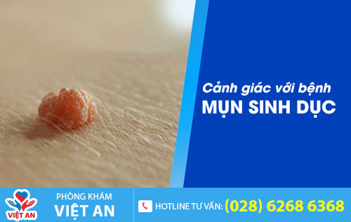 Cảnh giác với bệnh mụn sinh dục
