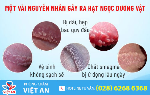nguyen nhan gay ra hat ngoc duong vat