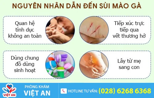 nguyen nhan sui mao ga
