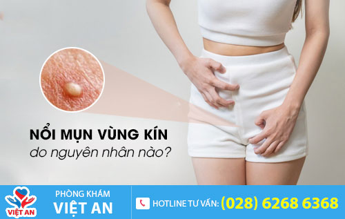 Nổi mụn vùng kín