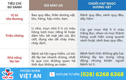 Phân biệt chuỗi hạt ngọc dương vật và sùi mào gà