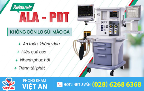 Phương pháp ALA -PDT