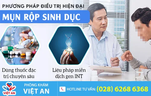 phuong phap dieu tri hien dai mun rop sinh duc