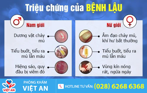 Triệu chứng của bệnh lậu