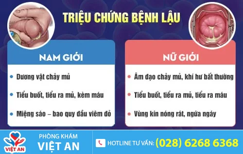 trieu chung benh lau