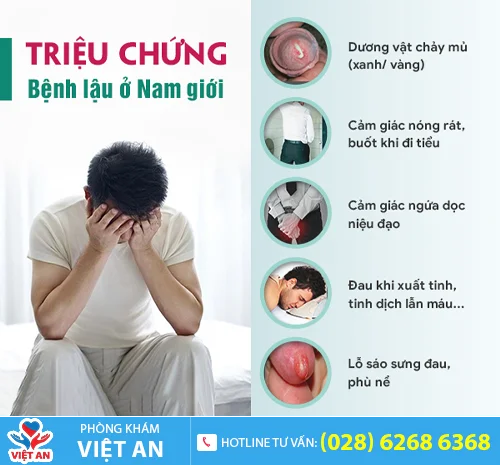 trieu chung lau o nam gioi