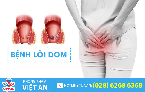Bệnh lòi dom