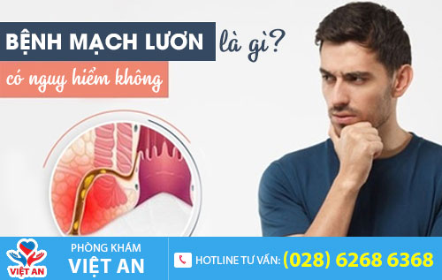 Bệnh mạch lươn là gì?