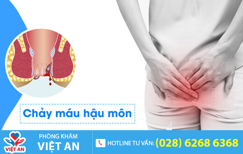 Chảy máu hậu môn