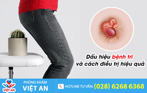 bệnh trĩ