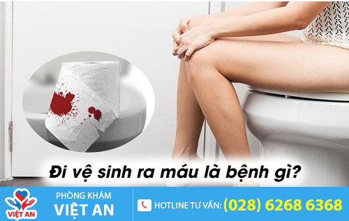 Đi vệ sinh ra máu