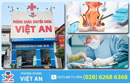 Địa chỉ cắt trĩ uy tín